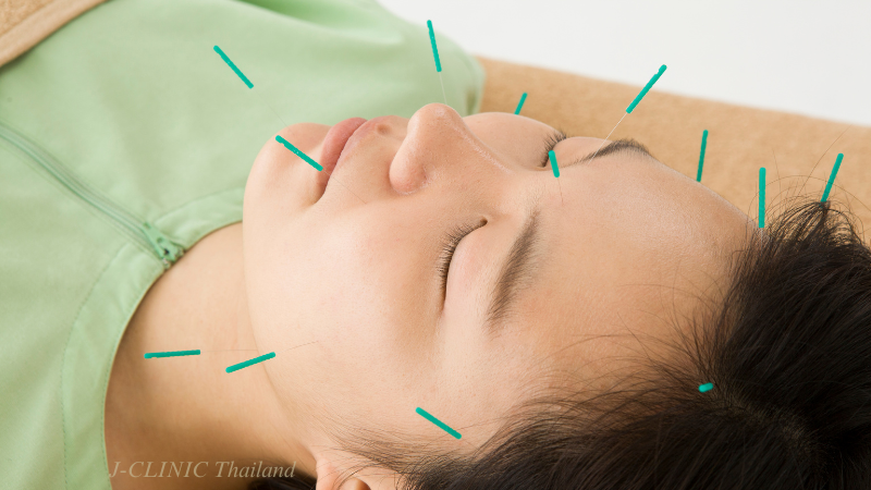 顔に鍼がささっている女性