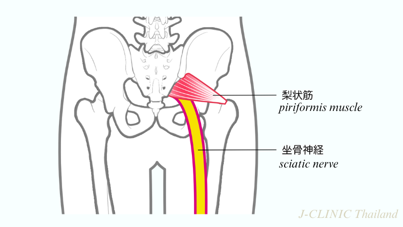 坐骨神経と梨状筋のイラスト