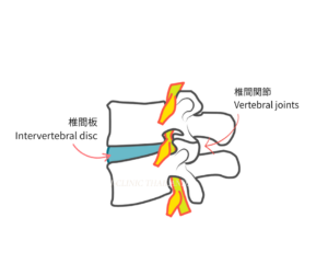 腰椎椎間板と椎間関節を説明するイラスト