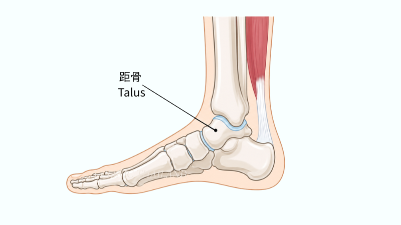 足首の解剖イラスト。距骨(Talus)の位置を示し、足首の捻挫や古傷による関節機能の低下を説明する医療イラスト。
