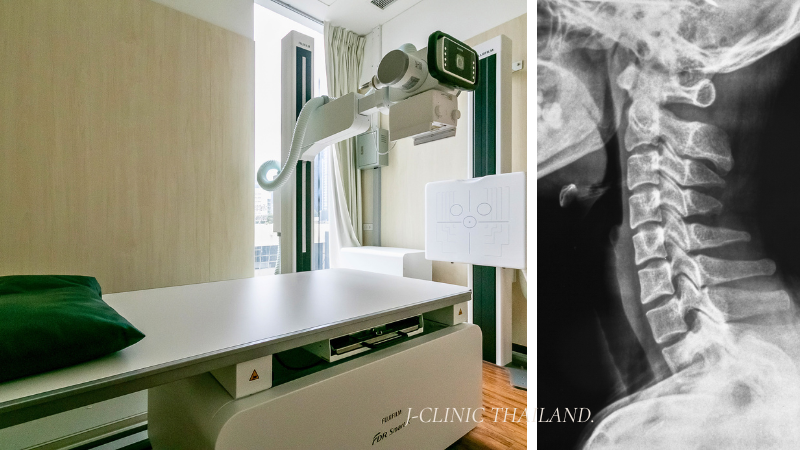 J-CLINICのレントゲン設備と頚椎の画像