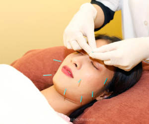 Needles in the face