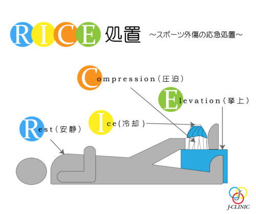 A illustration of the RICE procedure 
