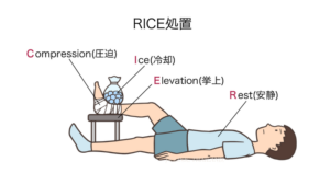 横になっている男性が右足を台の上にあげて、氷が入った袋で冷やしている