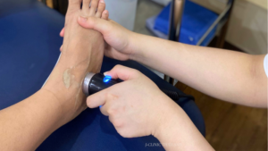 足首に超音波治療をしている写真