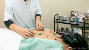 中医師が患者様の背中に鍼を打って、そこにパルス電流を流す施術をしている