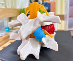 脊椎の模型、椎間関節の部分をテーピングで巻いている