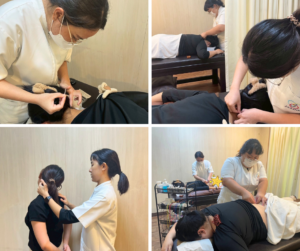 触診したり、鍼をうつセラピスト