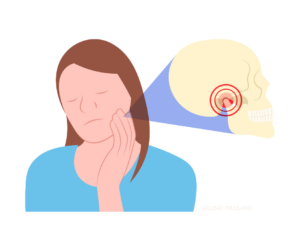 三叉神経痛のイラスト